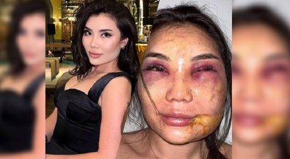 В Бишкеке муж жестоко избил жену. Милиция разыскивает подозреваемого